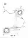 Fig. 63 - Method and system for providing therapy for bulimia/eating disorders by providing electrical pulses to vagus nerve(s)