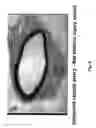 Fig. 09 - Electrical devices and anti-scarring agents
