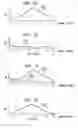 Fig. 08 - Compressed neural coding