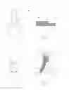Fig. 02 - Bifurcation stent delivery system