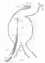Fig. 06 - Apparatus and method for the articulation of a catheter
