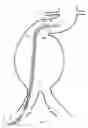 Fig. 08 - Apparatus and method for the articulation of a catheter