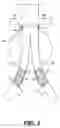 Fig. 03 - Apparatus and method for performing a surgical procedure