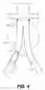 Fig. 05 - Apparatus and method for performing a surgical procedure