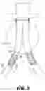 Fig. 06 - Apparatus and method for performing a surgical procedure