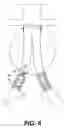 Fig. 07 - Apparatus and method for performing a surgical procedure