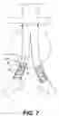 Fig. 08 - Apparatus and method for performing a surgical procedure