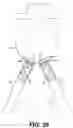 Fig. 17 - Apparatus and method for performing a surgical procedure