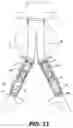 Fig. 20 - Apparatus and method for performing a surgical procedure
