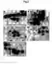 Fig. 03 - Xenograft model of functional normal and malignant human breast tissues in rodents and methods thereof