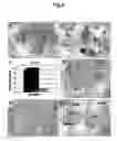 Fig. 06 - Xenograft model of functional normal and malignant human breast tissues in rodents and methods thereof