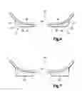 Fig. 05 - Swim goggles