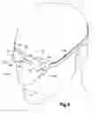 Fig. 06 - Swim goggles