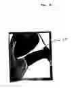 Fig. 07 - Adjustable concealed body armor