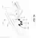 Fig. 06 - Pediatric emergency transport device