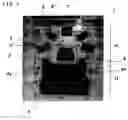 Fig. 02 - Appliance for adjusting points of upper body in good limb