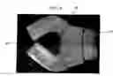 Fig. 09 - Appliance for adjusting points of upper body in good limb