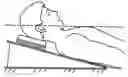 Fig. 01 - Active head/neck positioning device for endotracheal intubation