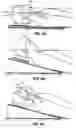 Fig. 06 - Active head/neck positioning device for endotracheal intubation
