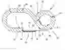 Fig. 01 - Snap hook having lockable gate