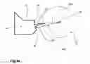 Fig. 09 - Tampon with ribs having a median diverging from the radius