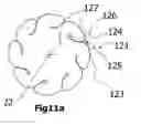 Fig. 22 - Tampon with ribs having a median diverging from the radius
