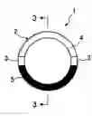 Fig. 01 - Ring