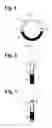 Fig. 02 - Ring