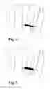 Fig. 03 - Ring