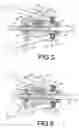 Fig. 06 - AUTOMOBILE STEERING WHEEL LOCK