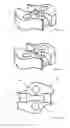 Fig. 06 - Configurations and designs for stump grinding teeth and corresponding holding brackets