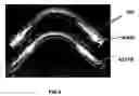 Fig. 04 - Moderate temperature bending of magnesium alloy tubes