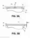 Fig. 04 - Method and apparatus for applying a gel