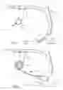 Fig. 02 - Furrow closer