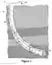 Fig. 02 - Rotating systems associated with drill pipe