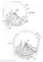 Fig. 07 - Roller cone drill bits with enhanced drilling stability and extended life of associated bearings and seals