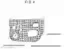 Fig. 04 - Speaker insulator and a speaker apparatus
