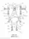 Fig. 02 - Footholds for fall protection devices