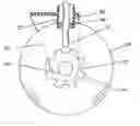 Fig. 01 - Hand deactivated shopping cart automatic braking system