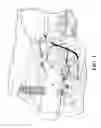 Fig. 02 - Disk brake