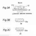 Fig. 04 - Ultrasonic bonding apparatus and method