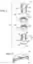 Fig. 13 - Adjustable sprinkler
