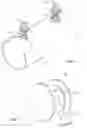 Fig. 02 - Irrigation pipe