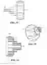 Fig. 09 - Bone crusher and method for bone crushing
