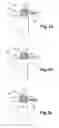 Fig. 03 - Mounting system inserted between an aircraft engine and a rigid structure of an attachment strut fixed under a wing of this aircraft