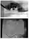 Fig. 06 - Fabric attachment device