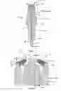 Fig. 03 - Spark plug having multiple point firing points