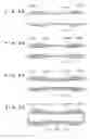 Fig. 04 - External electrode type discharge lamp and method of manufacturing the same