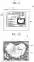 Fig. 10 - Method of controlling digital photographing apparatus for adaptive image compositing, and digital photographing apparatus using the method