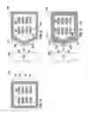 Fig. 04 - Local control of underfill flow on high density packages, packages and systems made therewith, and methods of making same